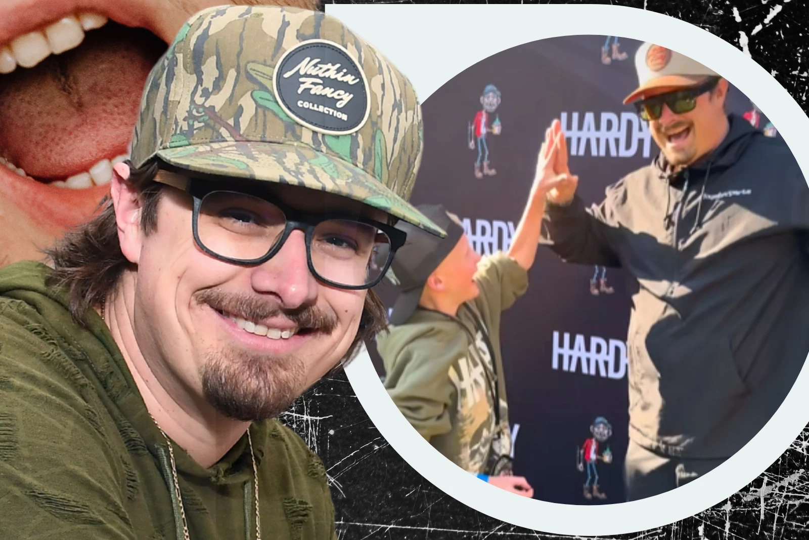 Hardy Pulls Out a Kid’s Tooth During Meet-and-Greet