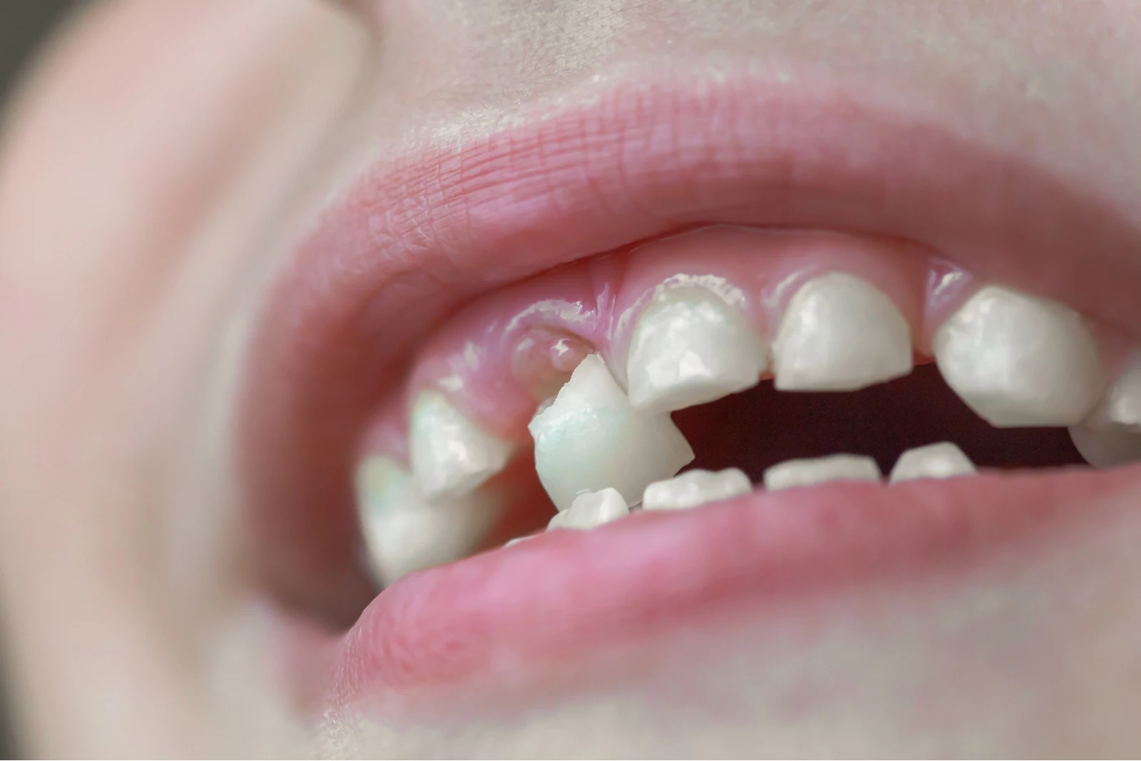 Jason Aldean’s Daughter Loses First Tooth During Christmas Outing