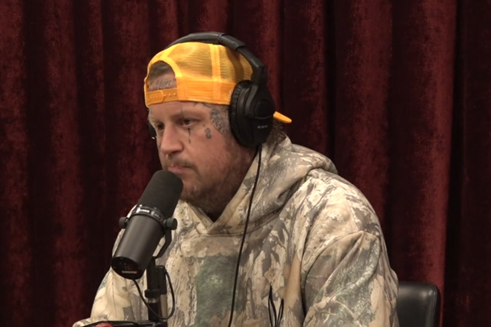 Jelly Roll Says He Doesn't Mind Extra Skin After Weight Loss