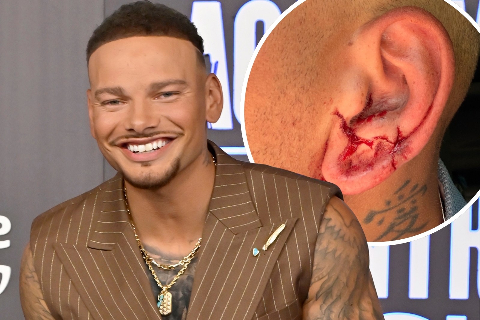 PICTURES: Kane Brown Suffers Concussion After Hit By Golf Ball