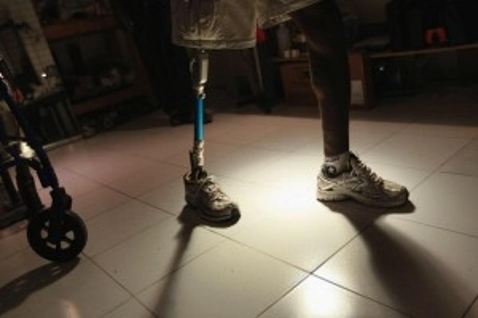 Man Uses Prosthetic Leg to Nab Robber