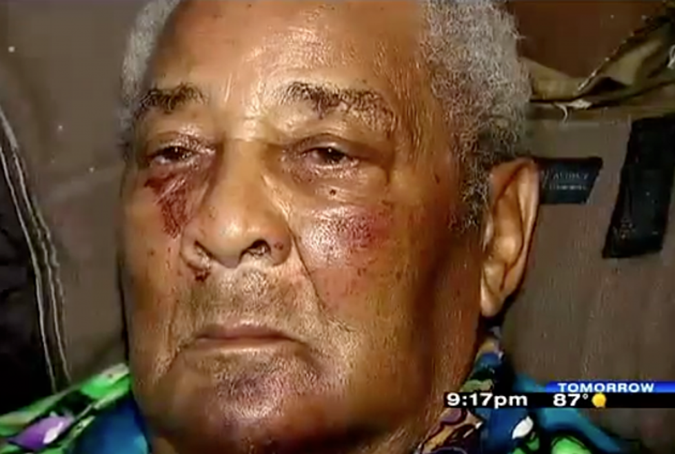 What the&#8230;? World War II Veteran Badly Beaten and Robbed by Teenage Thugs [POLL]