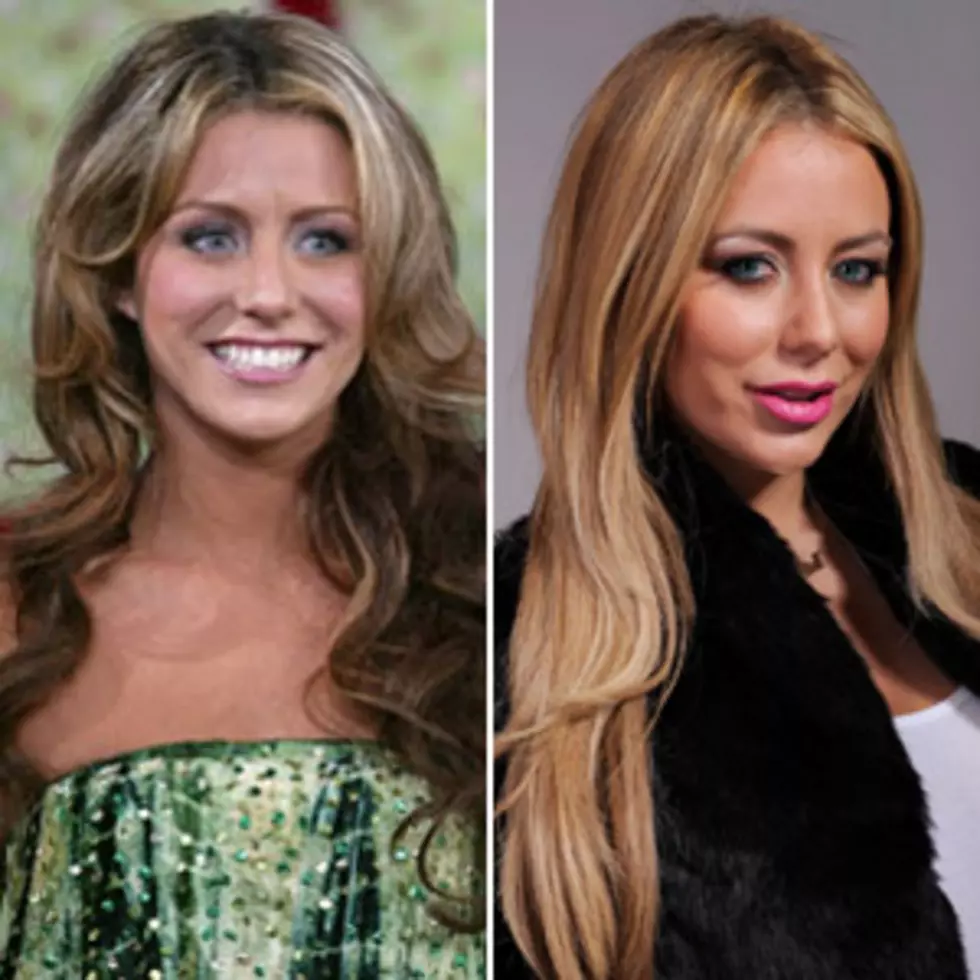 Aubrey O&#8217;Day Plastic Surgery Pictures