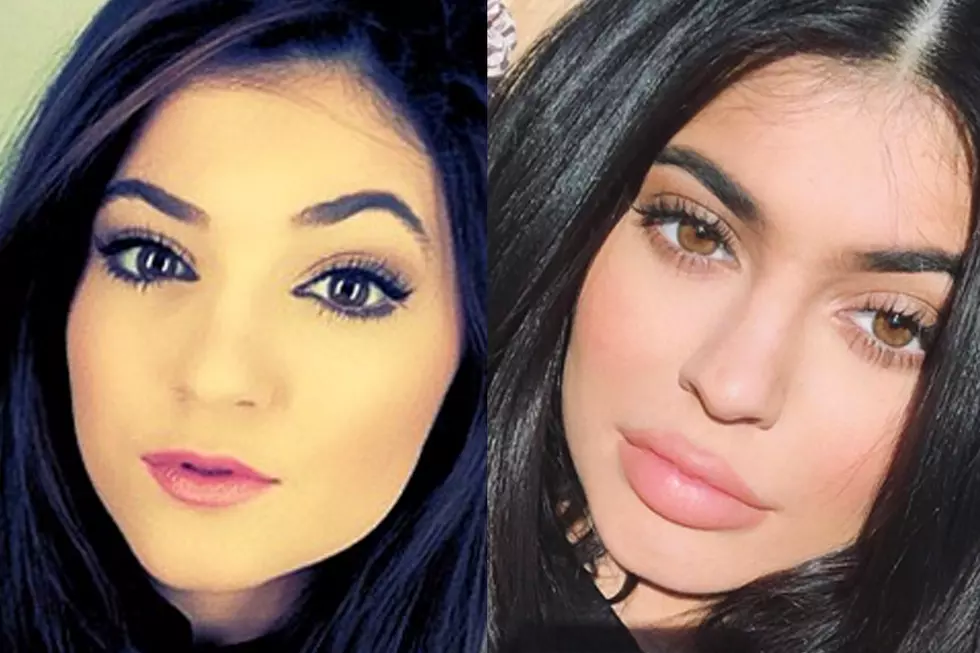 Kylie Jenner&#8217;s Lip Evolution