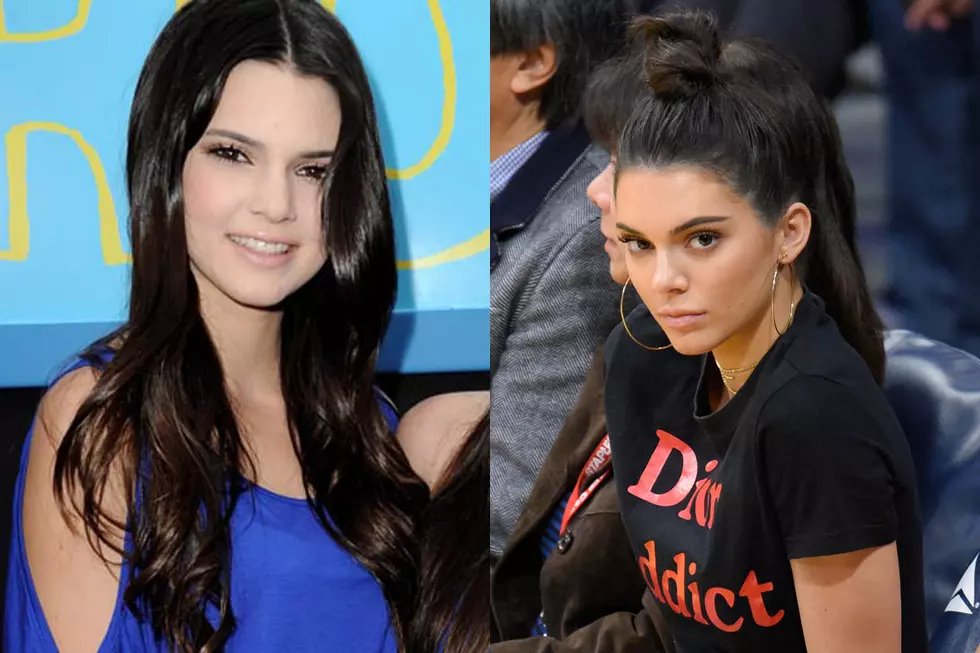 Kendall Jenner Denies ‘Crazy’ Facial Reconstruction Rumors