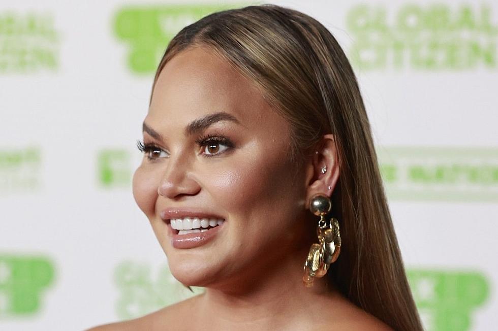 Chrissy Teigen Had an Eyebrow Transplant