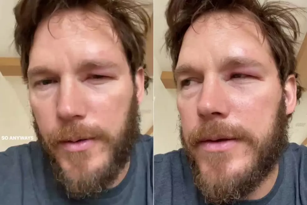 Chris Pratt Gets Stung in Eye by Bee, Blames Viral ‘Bee Lady’ Texas Bee Works