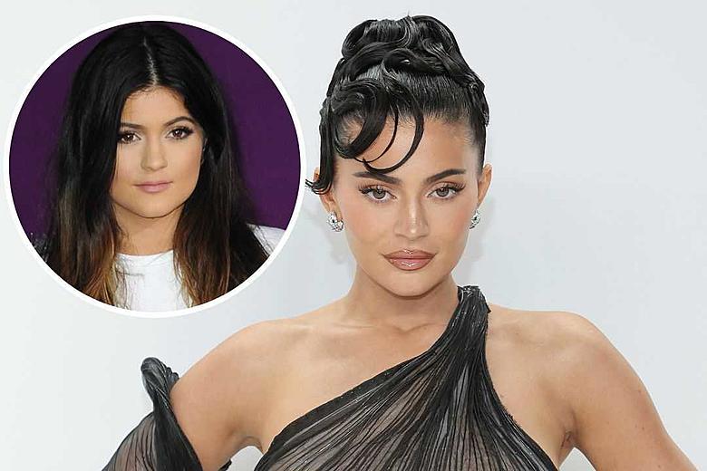 What Plastic Surgery Has Kylie Jenner Had Done?