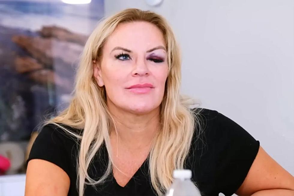 'RHOSLC' Star Heather Gay Reveals Who Caused Her Black Eye