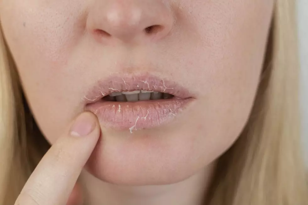 Do Chapsticks and Lip Balms Really Dry Out Your Lips in the Long Run?