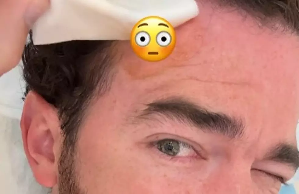 Kevin Jonas Has Skin Cancer Removed From Face