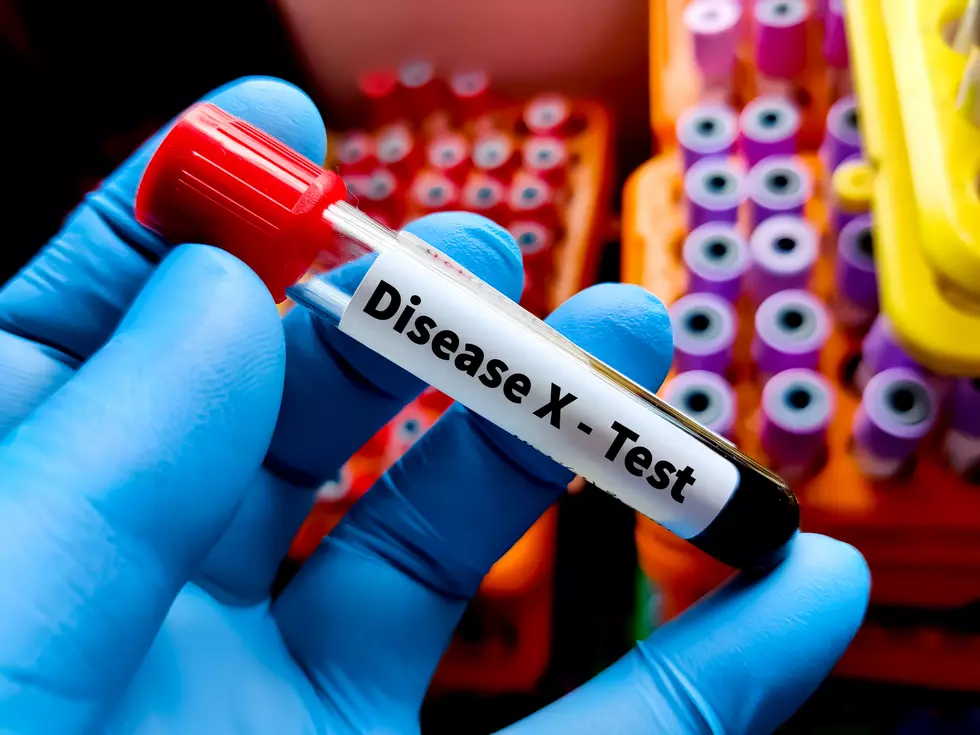 Diseases X biological specimens testing concept.