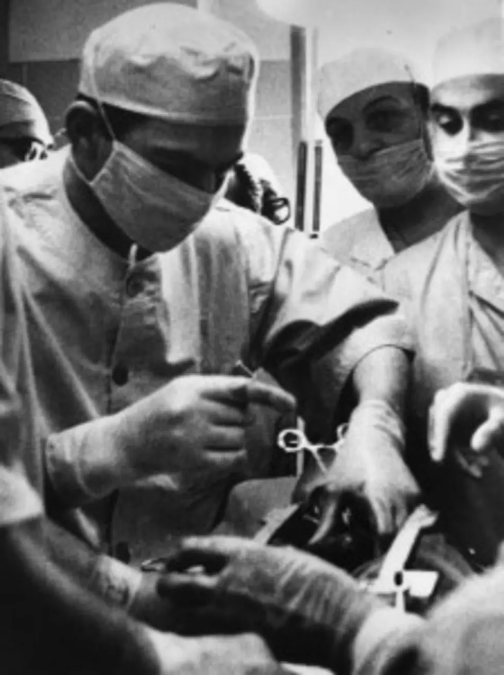 The First Human Heart Transplant
