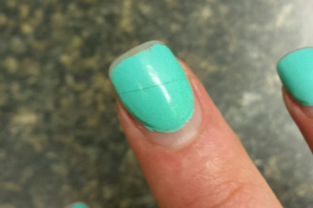 11 Tips For Getting Rid Of Unsightly Fingernail Ridges