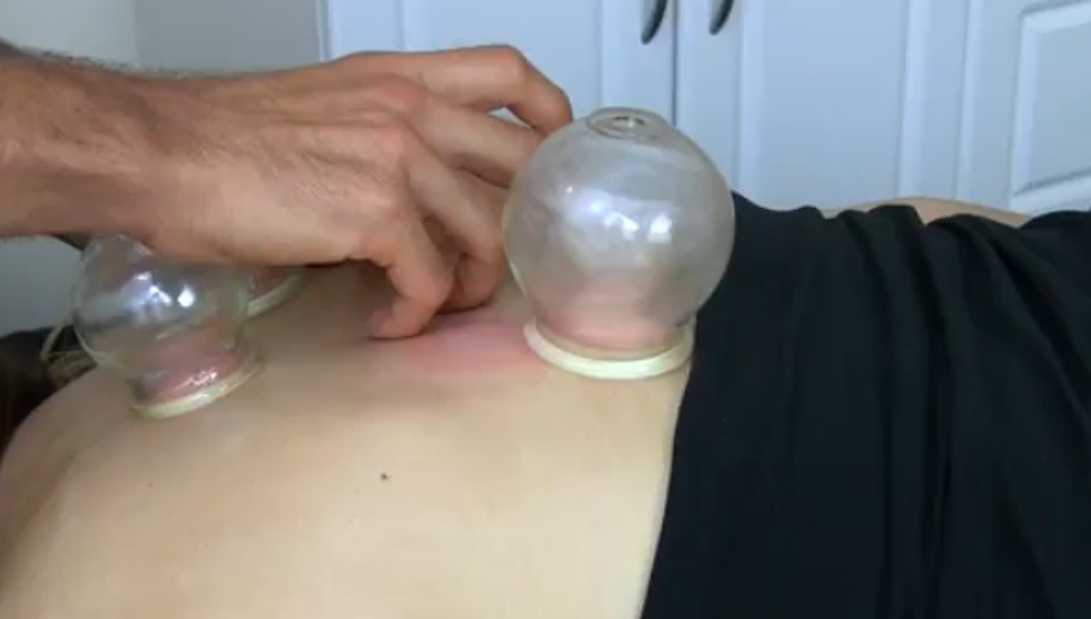 Celebrities Are Cupping, You May Want To Try It [VIDEOS]
