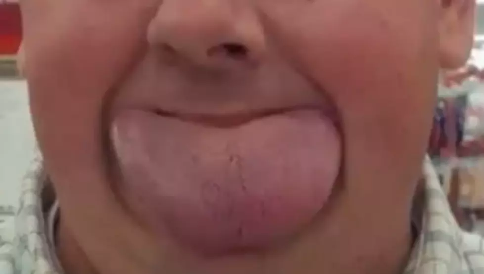 Byron Schlenker Breaks World Record For Widest Tongue [PICS/VIDEO]
