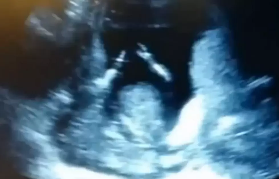 Ultrasound Of Baby Shows It Clapping Inside Mother While She Sings [AMAZING VIDEO]