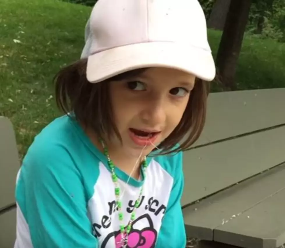 Dad Uses Live Squirrel To Pull Daughter’s Tooth [VIDEO]