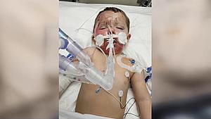 Louisiana Mother & Son Burnt in Shocking Aerosol Can Explosion