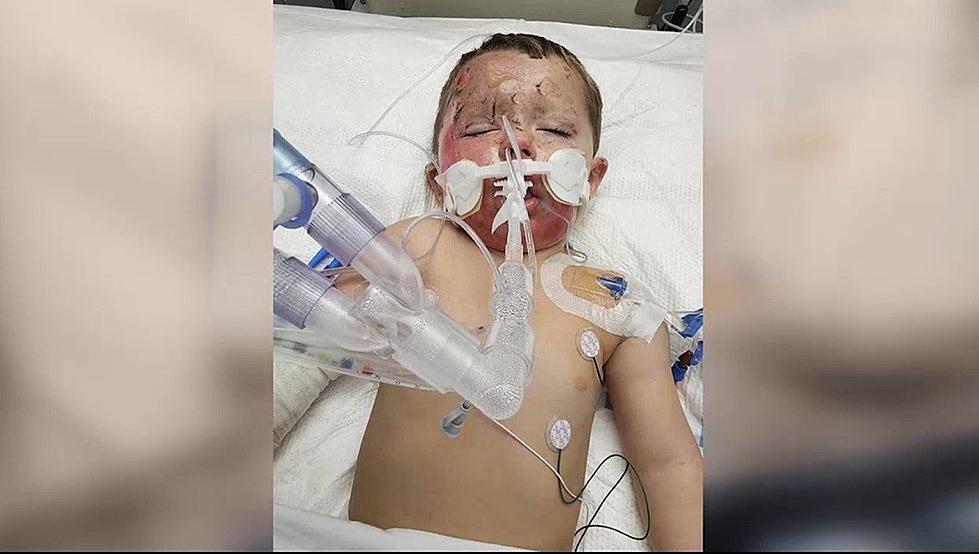 Louisiana Mother &#038; Son Burnt in Shocking Aerosol Can Explosion