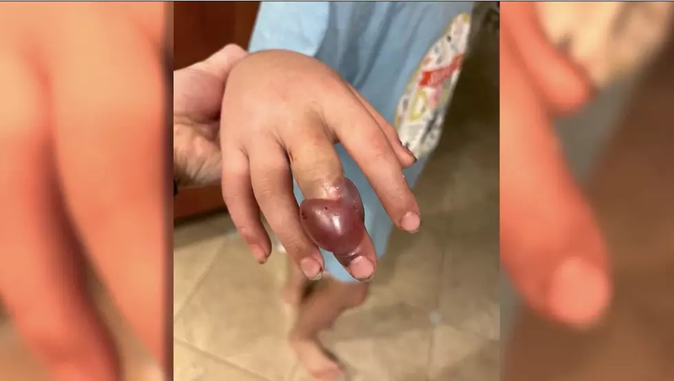 Texas Girl Bit by Venomous Snake, It’s a Warning for Us in Louisiana