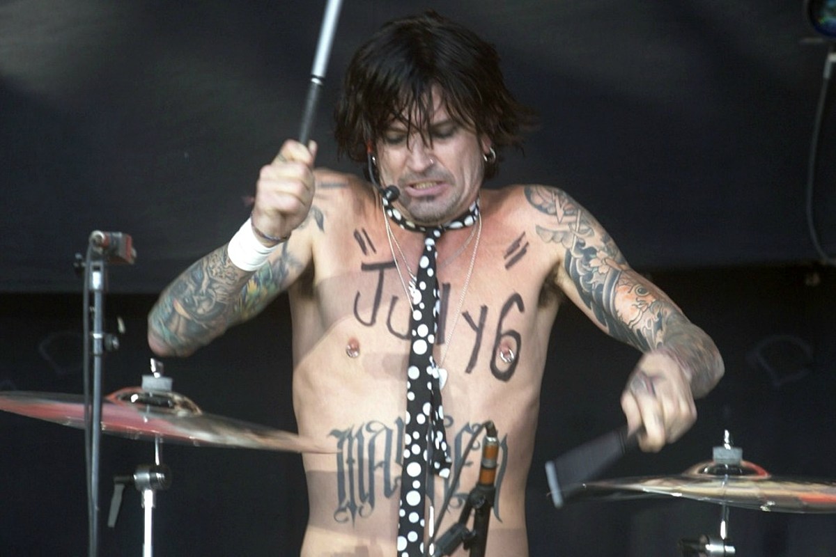 When Tommy Lee Was Burned by Pyrotechnics During a Concert