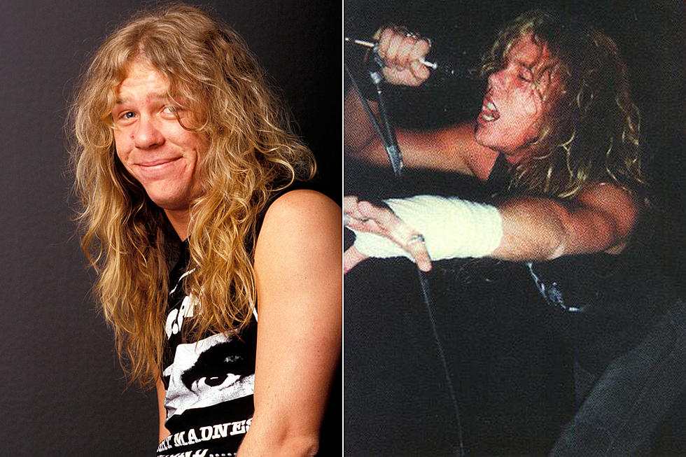 When Metallica Expanded After James Hetfield Broke His Wrist