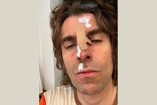 Liam Gallagher Injured After Falling Out of a Helicopter