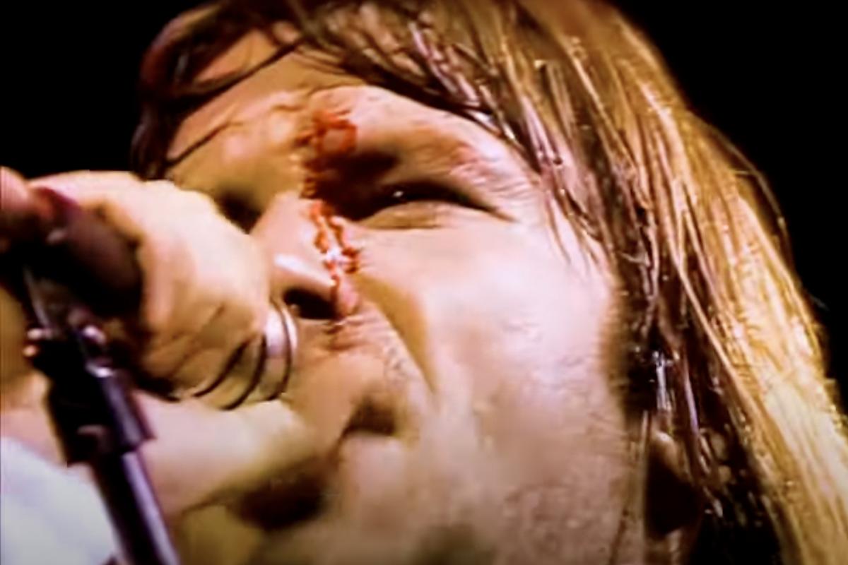 A Bruce Dickinson Onstage Injury Helped Iron Maiden Break the US