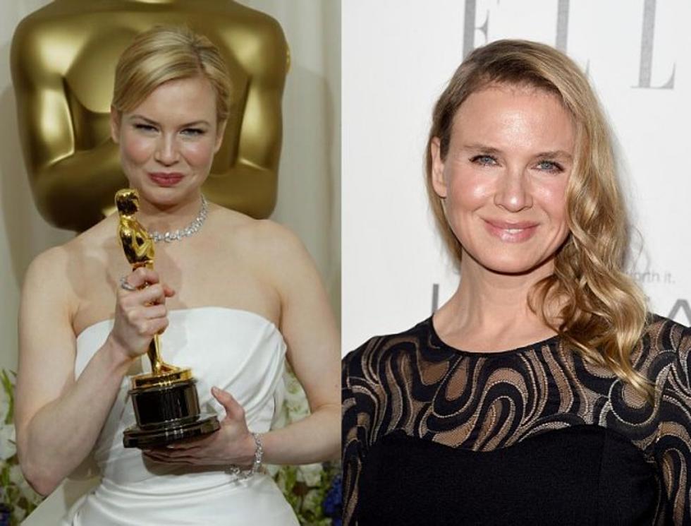 You May Not Recognize Renee Zellweger These Days