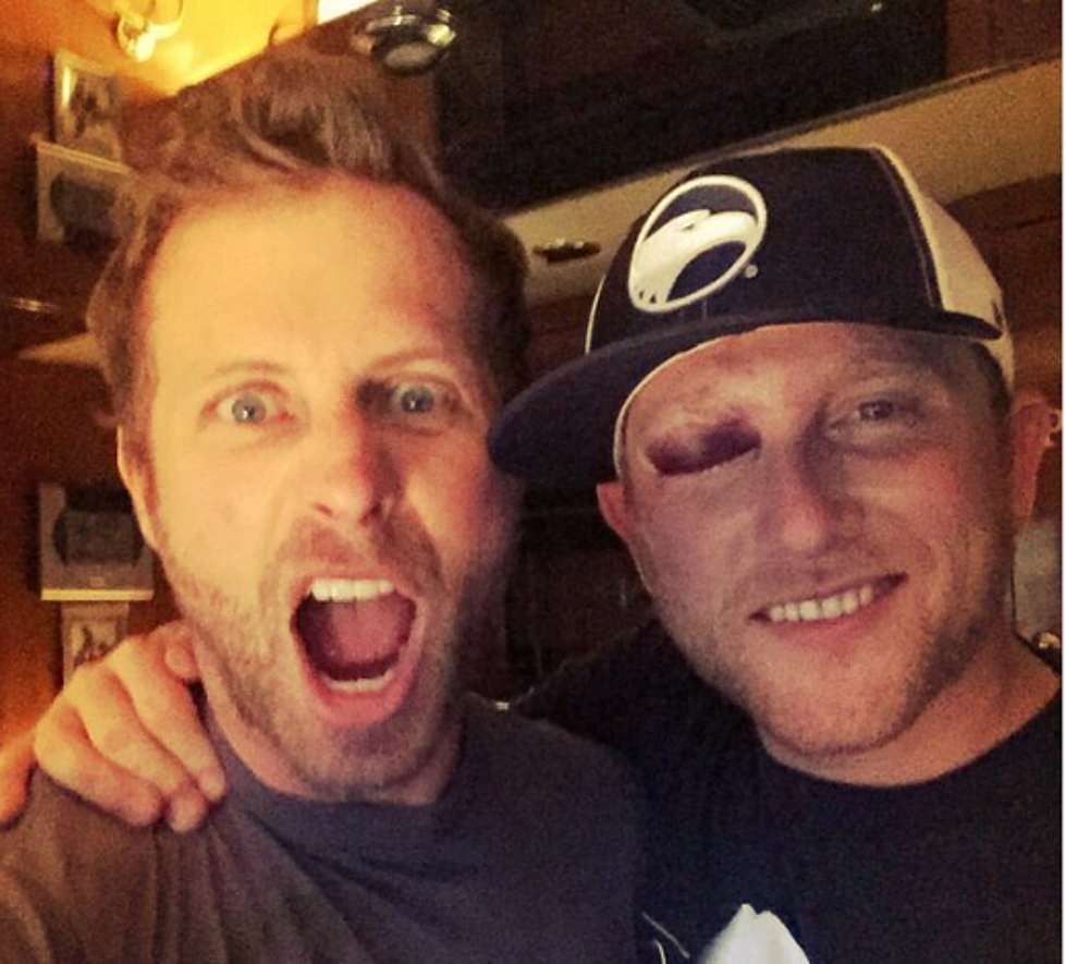 Cole Swindell Got a Nasty Black Eye Over the Memorial Day Weekend