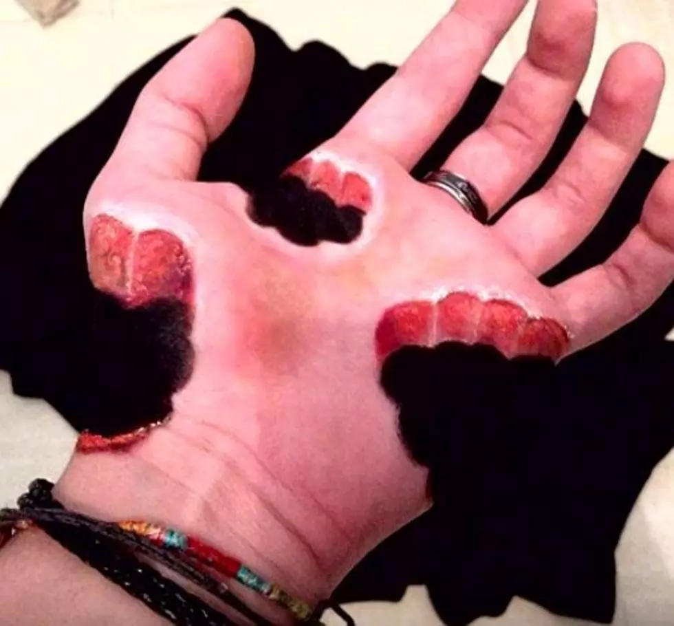 Horrific 3D Hand Bite Effect You Should Use For Your Halloween Costume [Video]