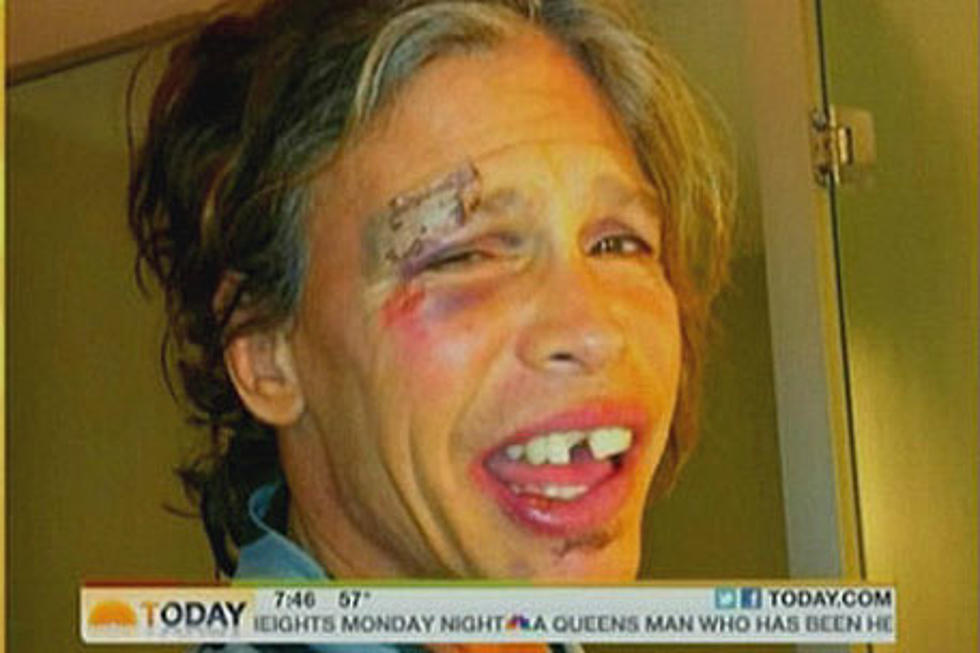 Steven Tyler Jacks Up His Face In A Nasty Fall, Promises He’s Still Sober [VIDEO]