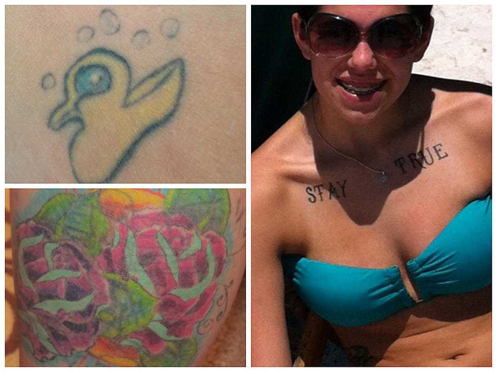 Finalists For The ‘Undo Your Tattoo’ Contest – Vote Now