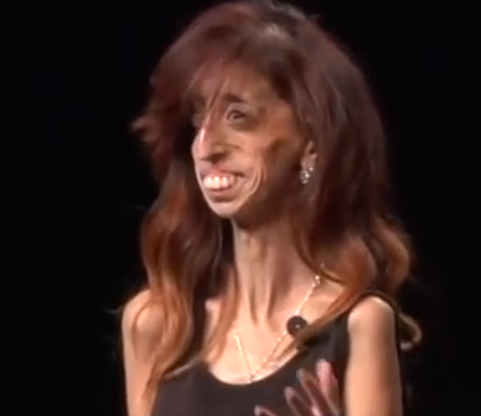 Labeled “World’s Ugliest Woman” One Woman Turns Ugly Comments Into Inspirational Speech [VIDEO]
