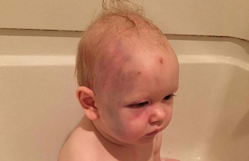 Couple Seeks Justice On Social Media After Son Allegedly Assaulted By Babysitter [PHOTOS]