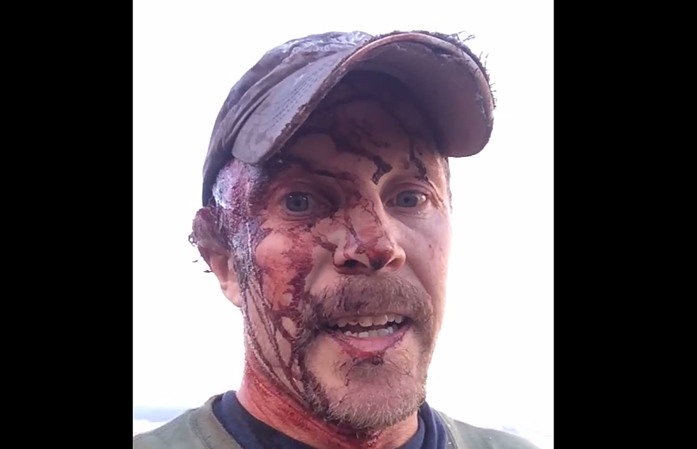 Man Posts Video To Facebook Right After Being Attacked By A Grizzly Bear