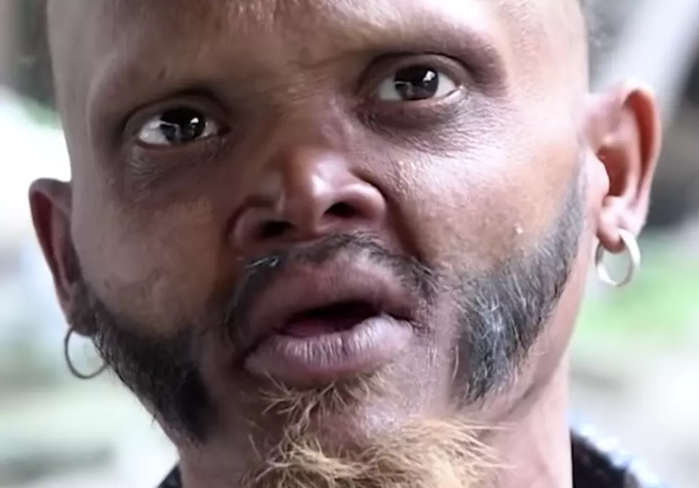 Man Has Bizarre Talent, Can Touch His Forehead With Tongue [VIDEO]