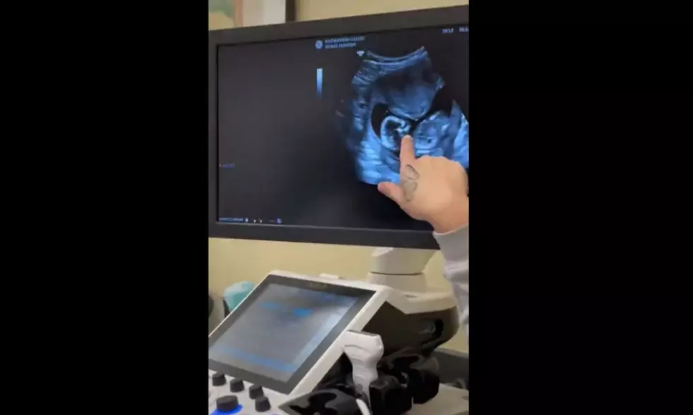 Sonography Student Shocked After Finding Out She’s Pregnant With ‘Surprise’ Baby During Class