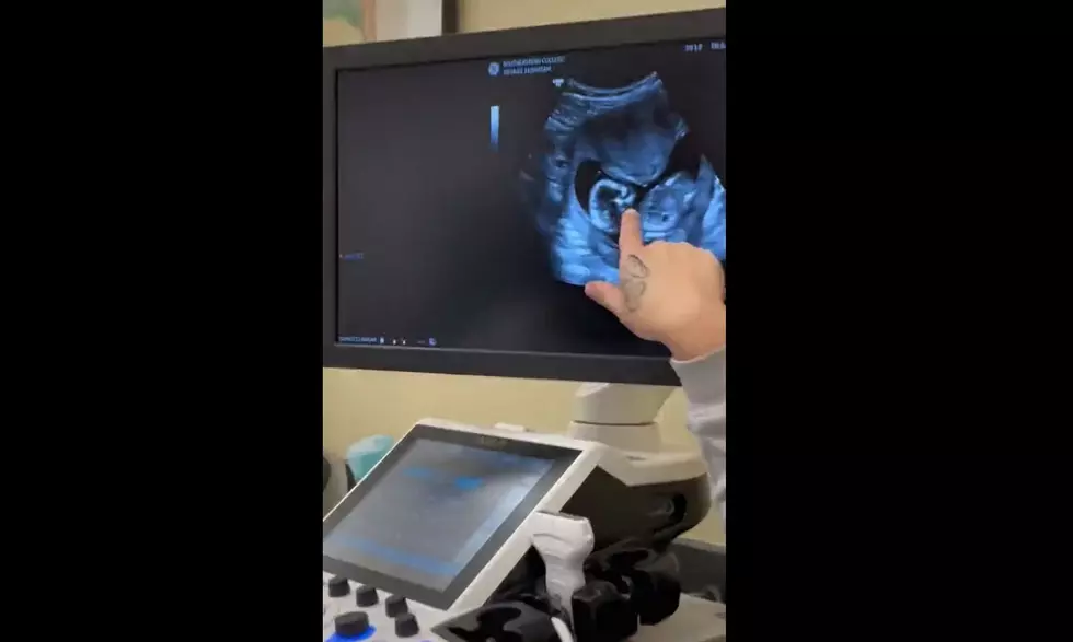 Sonography Student Finds Out She's Pregnant With 'Surprise' Baby