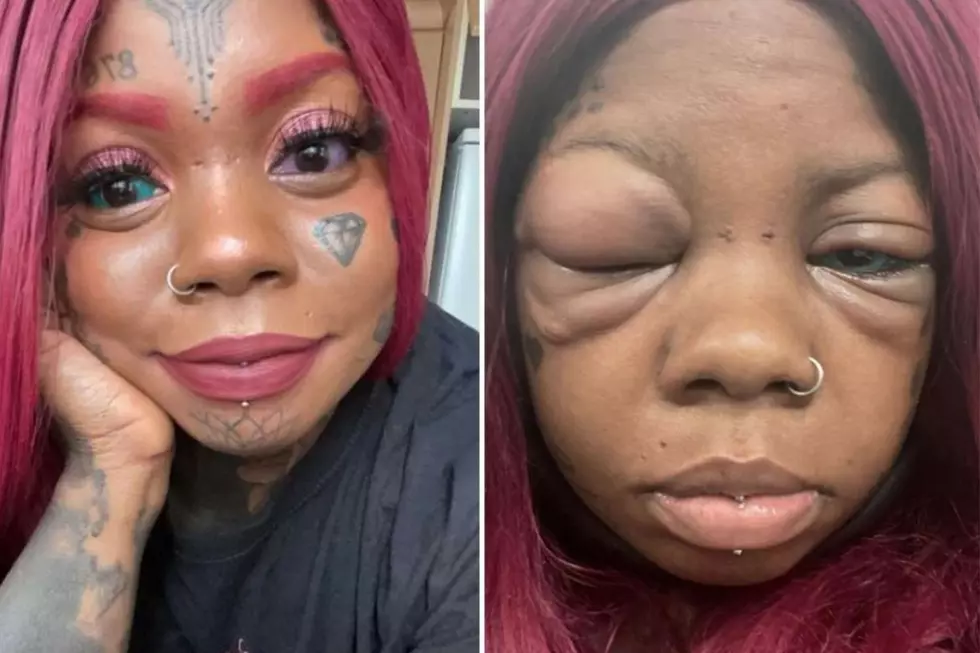 Woman Going Blind After Tattooing Her Eyeballs Purple and Blue