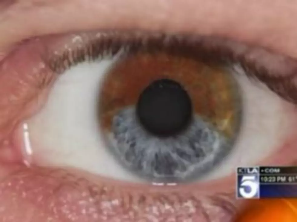 Breakthrough Laser Procedure Permanently Turns Brown Eyes Blue [VIDEO]