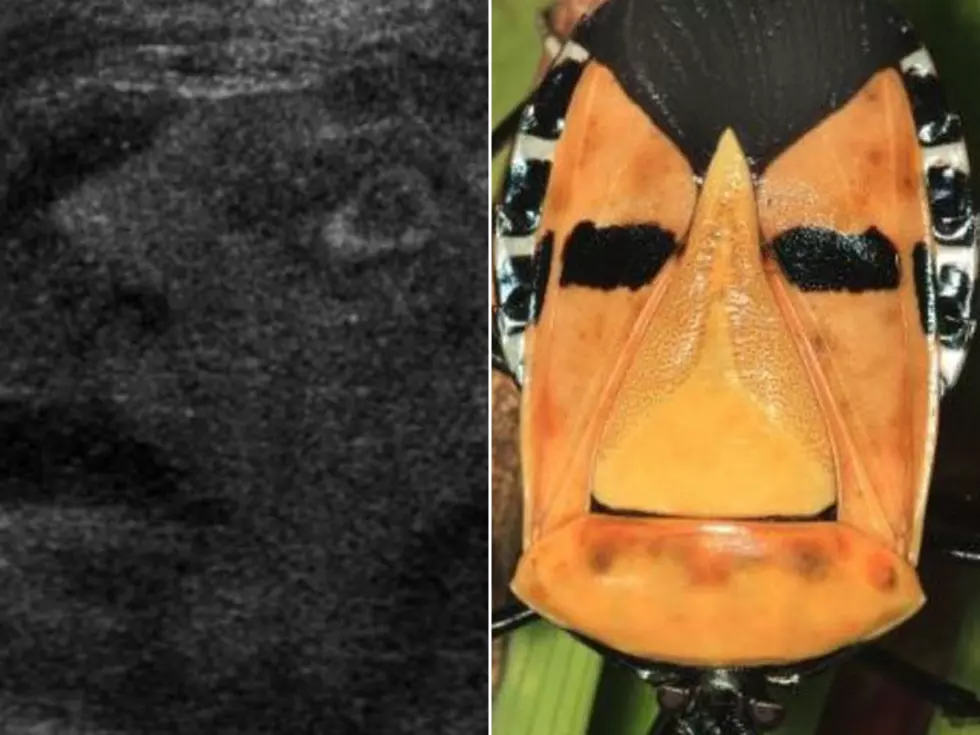 5 Miraculous Faces Found in Bizarre Locations [PHOTOS]