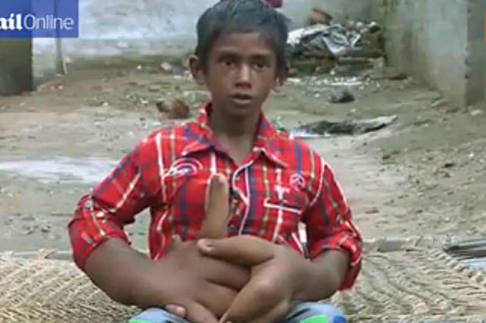 Boy With 18-Pound Hands Is a Medical Mystery
