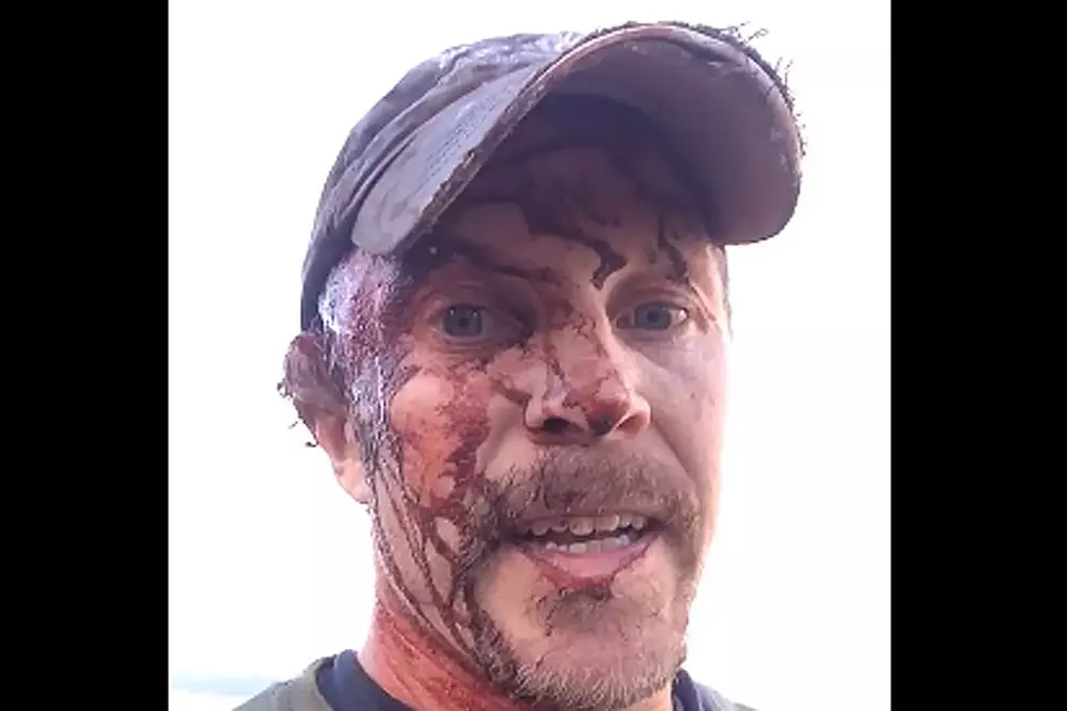 Blood-Covered Man Lives to Describe His 2 Bear Attacks
