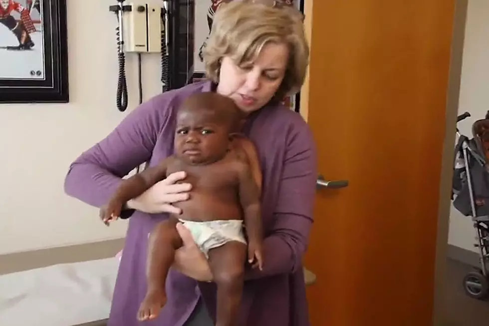 Baby Born With 4 Legs Has 2 Removed, Okay After Miraculous Surgery