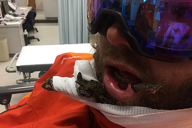 Chillaxed Skier With Branch Impaled in Mouth Needs Your Help