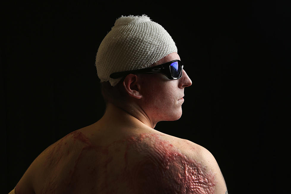‘Skin Gun’ Has The Technology To Spray Skin Back On Burn Victims [Video]