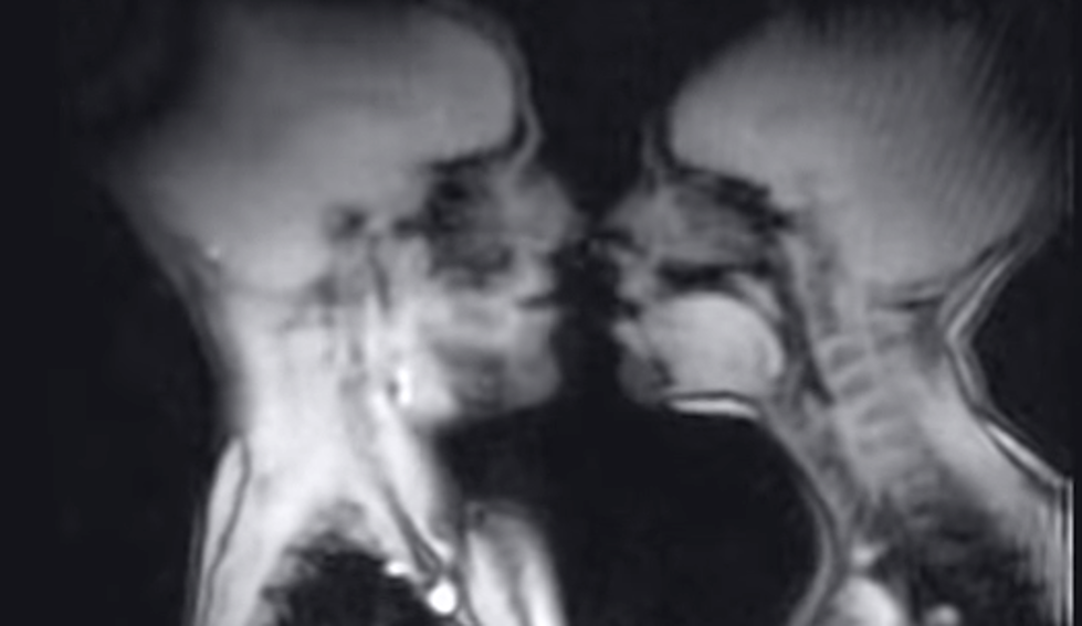 This Is What Sex Looks Like Inside An MRI Scanner [NSFW Video]