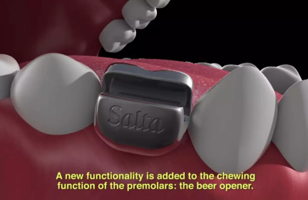 Rugby Players Have Bottle Openers Implanted Where Teeth Use To Be [Video]